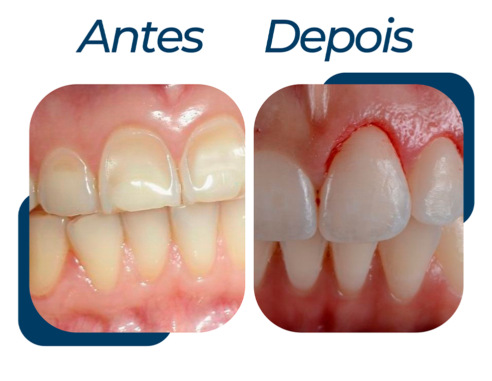 ANTES-DPS-2.png