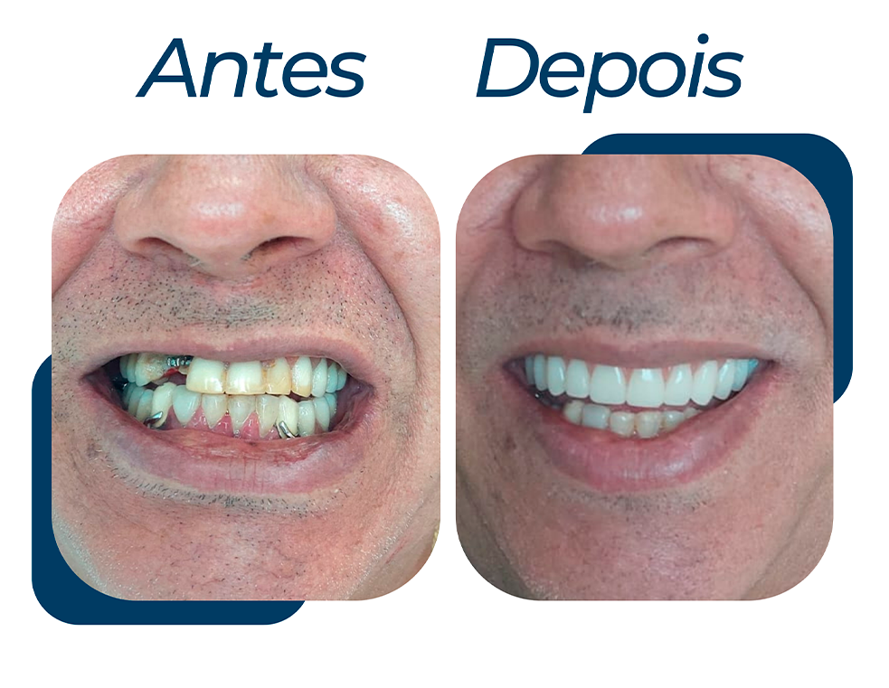 ANTES-DPS-5.png