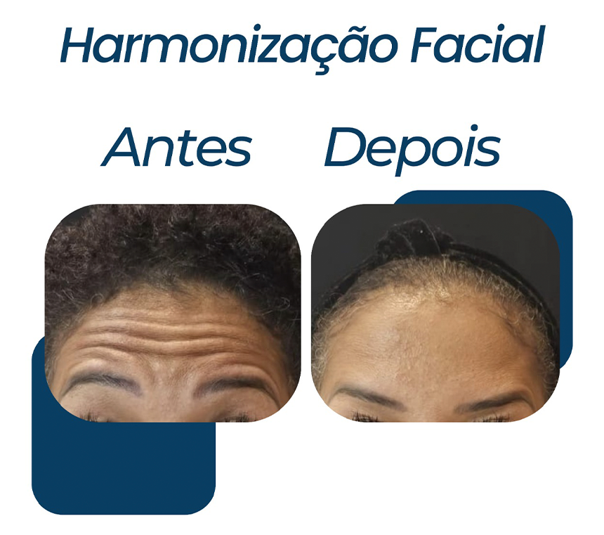 ESPECIALIDADE-1.png