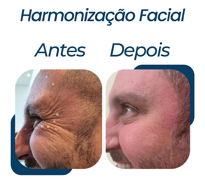 ESPECIALIDADE-2.png