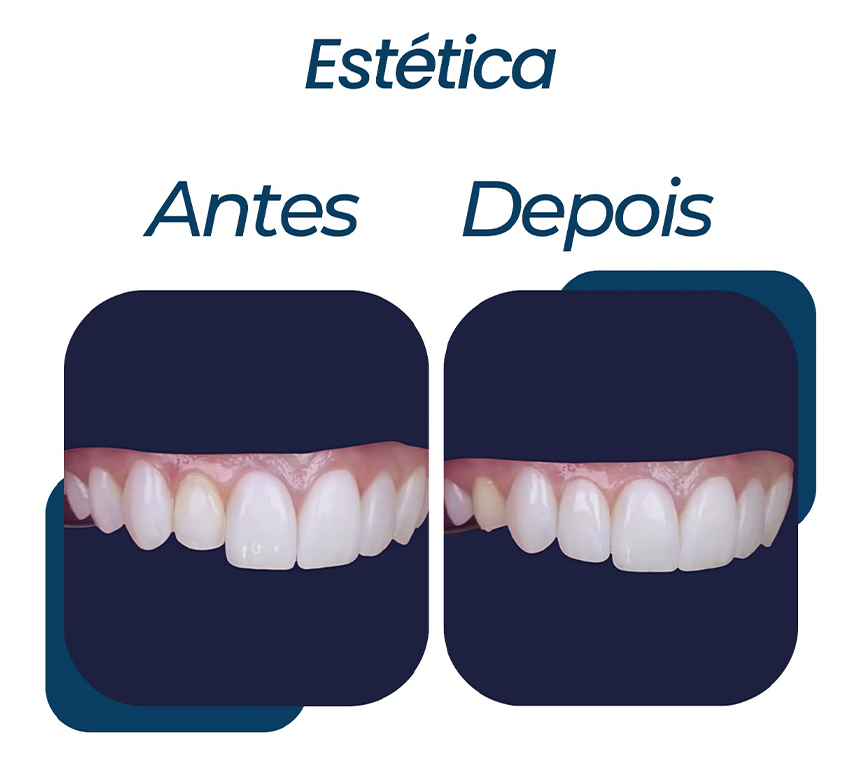ESPECIALIDADE-6.png